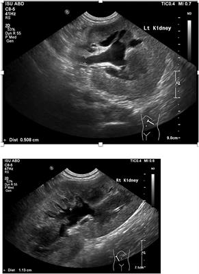 Case Report: Successful Management and Long-Term Follow-Up of Bilateral Ureteral Ligation in a Dog Secondary to Cryptorchid Castration Utilizing Bilateral Ureteral Stents and a Neoureterocystostomy Procedure